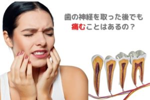 歯の神経を取った後でも痛むことはあるの？｜香川県高松市　薬で治す虫歯治療　根管治療　歯の神経治療　吉本歯科医院