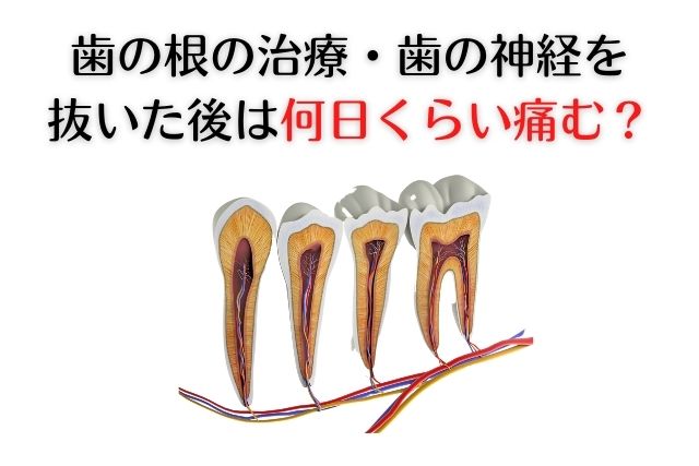 香川県高松市　薬で治す虫歯治療　根管治療　歯の神経治療　吉本歯科医院
