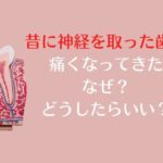 昔に神経を取った歯が痛くなってきた。なぜ？どうしたらいい？香川県高松市　薬で治す虫歯治療　根管治療　歯の神経治療　吉本歯科医院